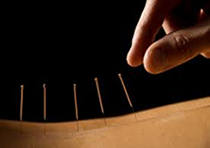 picture of acupuncture
